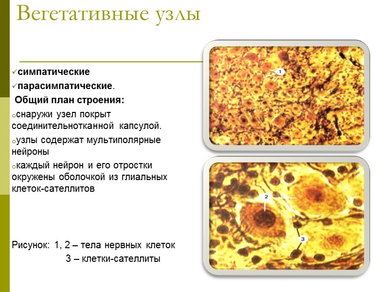 Вегетативные узлы симпатические  парасимпатические.   Общий план строения: снаружи узел покрыт соединительнотканной